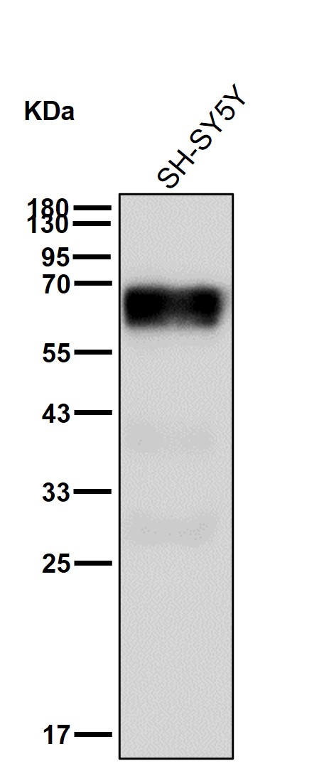 Lysosomal acid GCase Ab