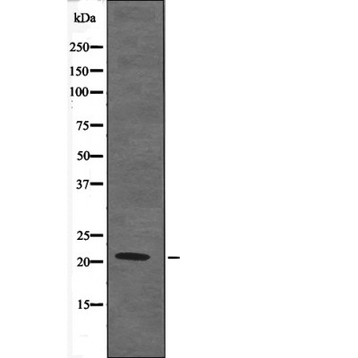 p-Claudin 4 (Y208) Ab