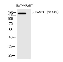 p-FANCA (S1149/S1449) Ab