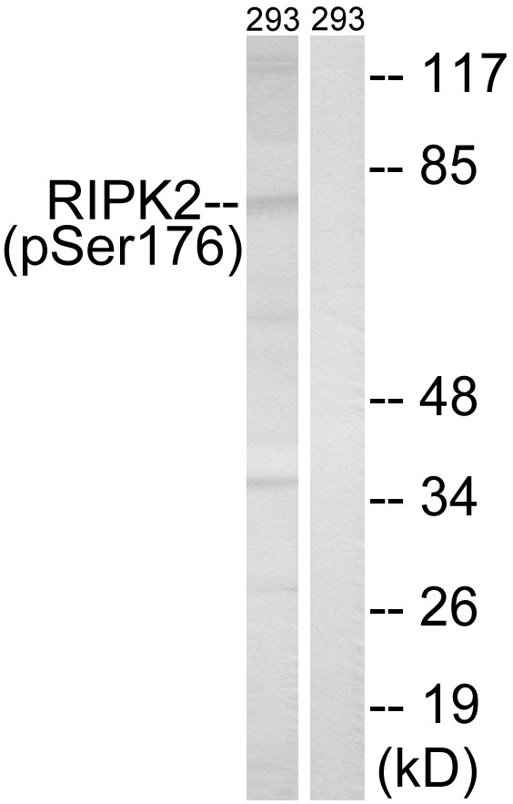 p-RIP 2 (S176) Ab