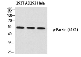 p-Parkin (S131) Ab