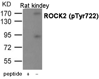 p-ROCK2 (Y722) Ab