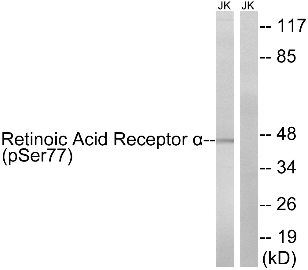 p-Retinoic acid receptor alpha (S77) Ab