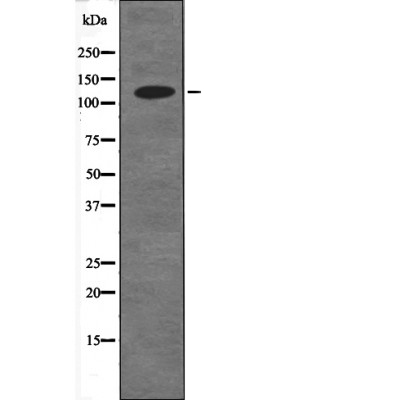 p-E Cadherin (S844) Ab