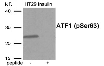 p-ATF1 (S63) Ab