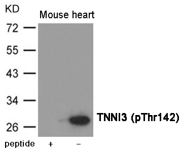 p-Troponin I (T143) Ab