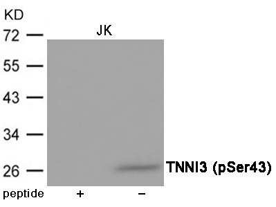 p-Troponin I (S44) Ab