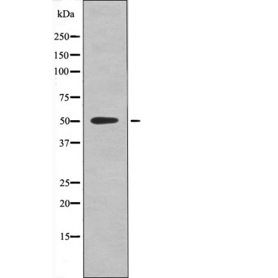 p-RXRA (S260) Ab