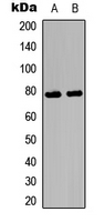 p-Ezrin/Radixin/Moesin (T567/T564/T558) Ab