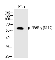 p-PPAR gamma (S112) Ab