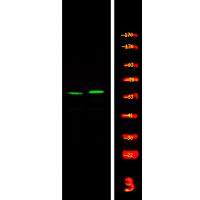 p-CSK (Y304) Ab