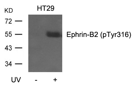 p-Ephrin B2 (Y316) Ab