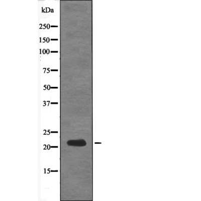 p-Calcipressin 1 (S108) Ab