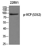 p-VCP (S352) Ab