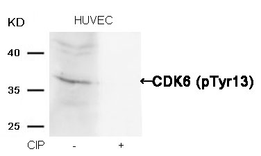 p-CDK6 (Y13) Ab