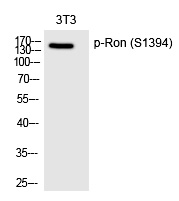 p-MSP receptor (S1394) Ab