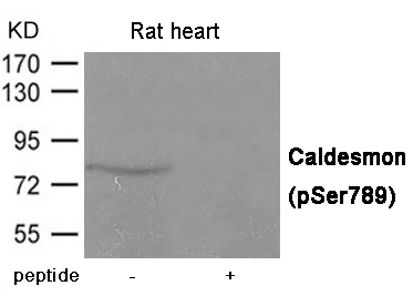 p-Caldesmon (S789) () Ab