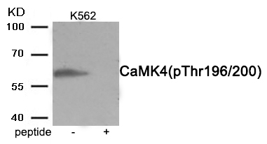 p-CaMKIV (T200) Ab