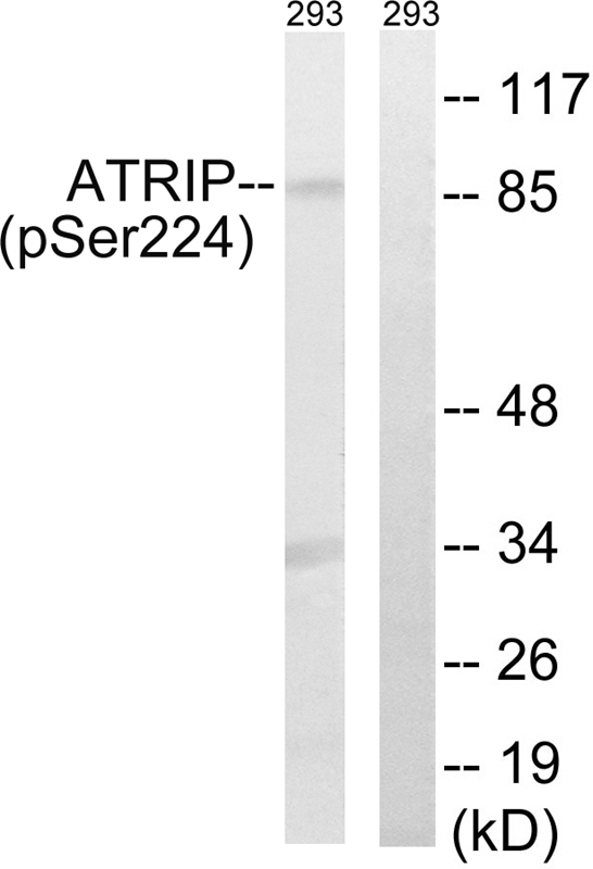 p-ATR interacting protein (S224) Ab