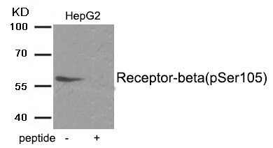 p-Estrogen receptor beta (S105) Ab