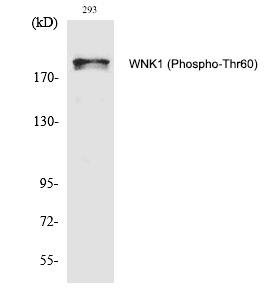 p-WNK1 (T60) Ab