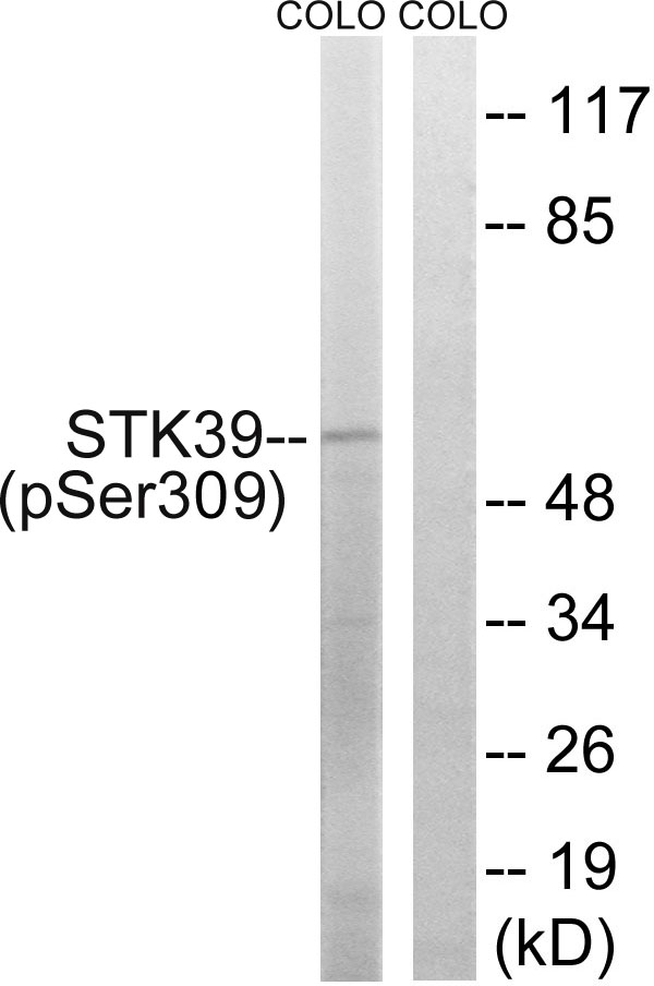 p-STK39 (S309) Ab