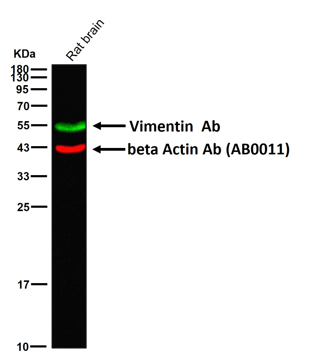 Vimentin Ab