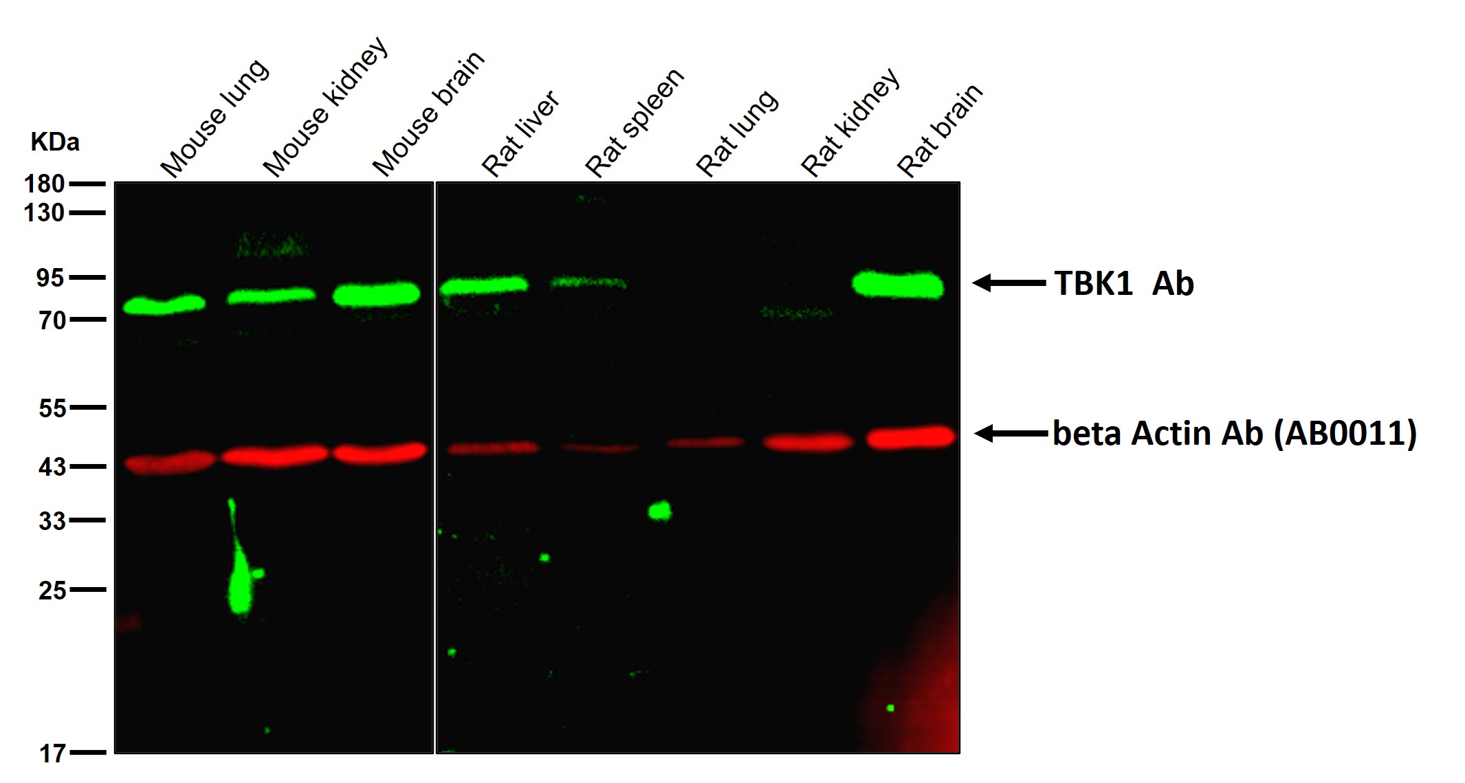 TBK1 Ab