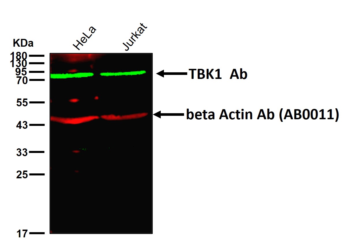 TBK1 Ab