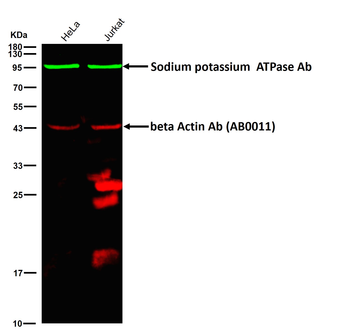 Sodium potassium ATPase Ab