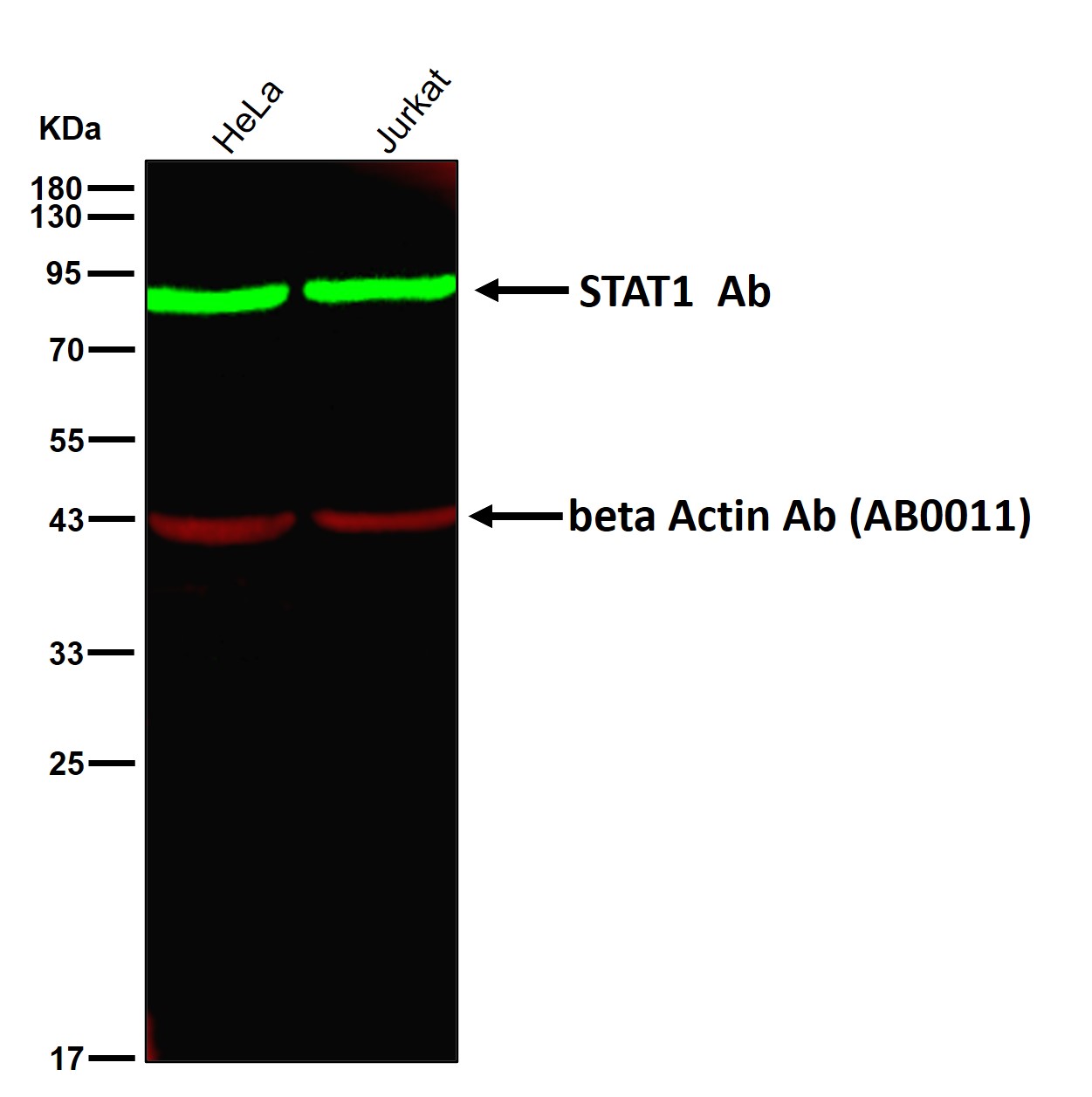 STAT1 Ab