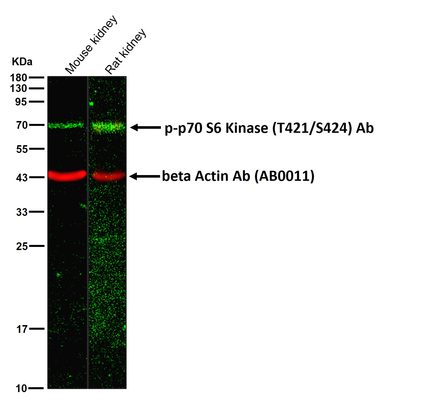 p-p70 S6 Kinase (T421/S424) Ab