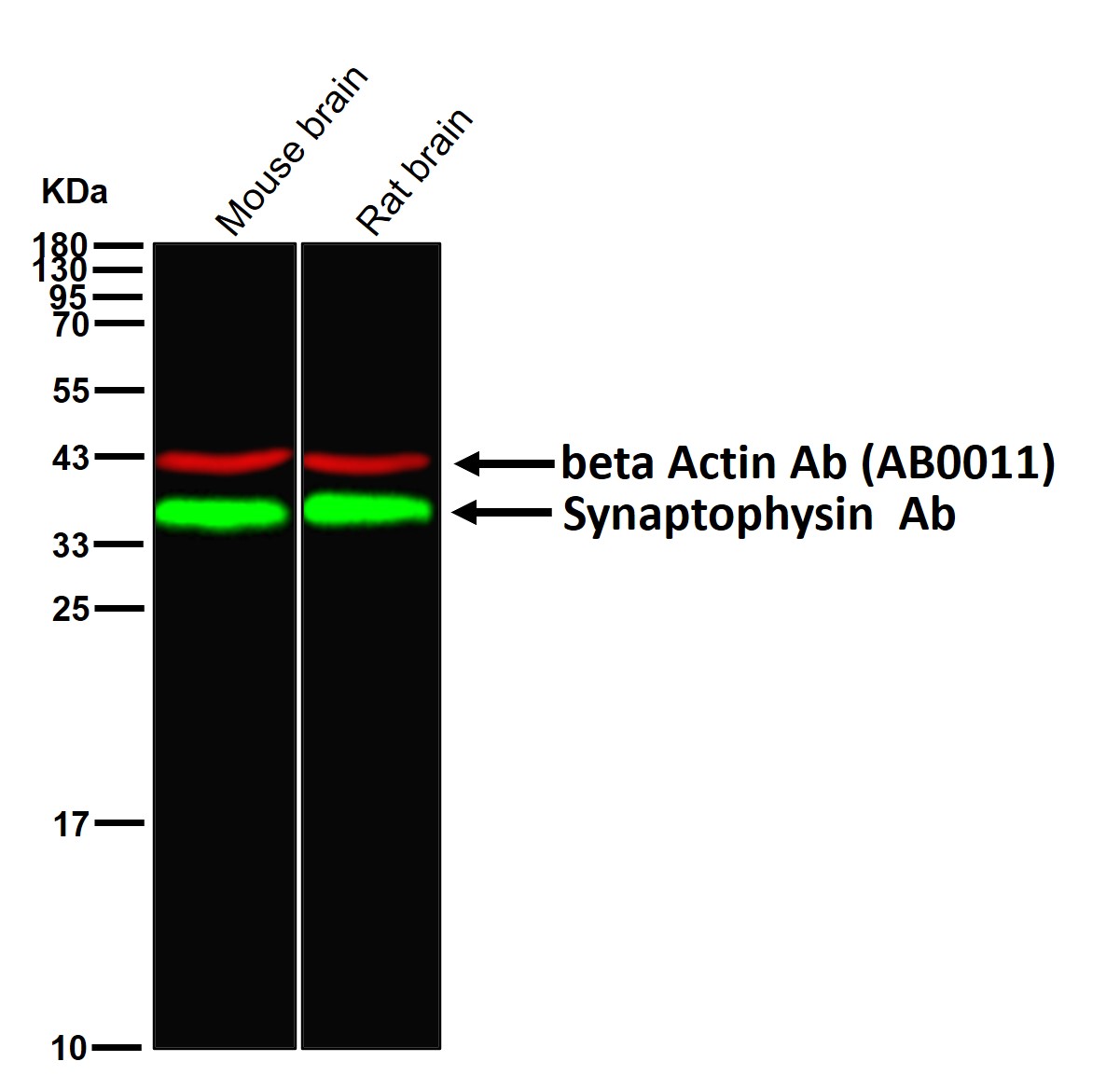 Synaptophysin Ab