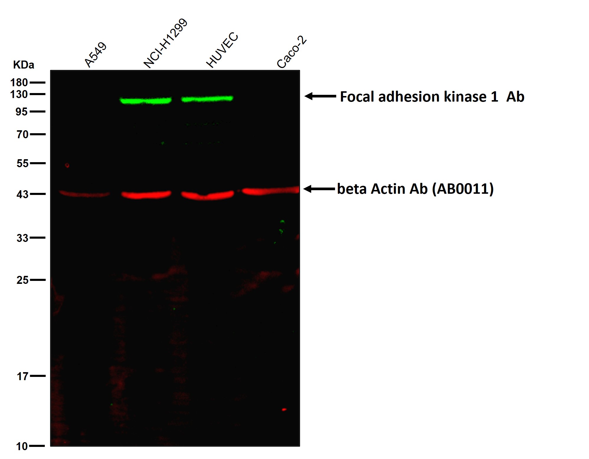 Focal adhesion kinase 1 Ab