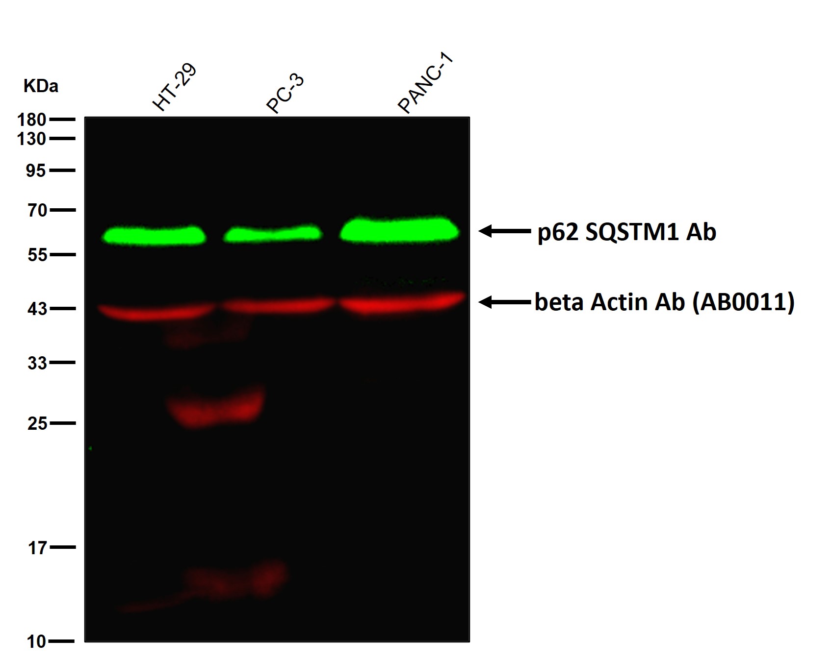 p62 SQSTM1 Ab