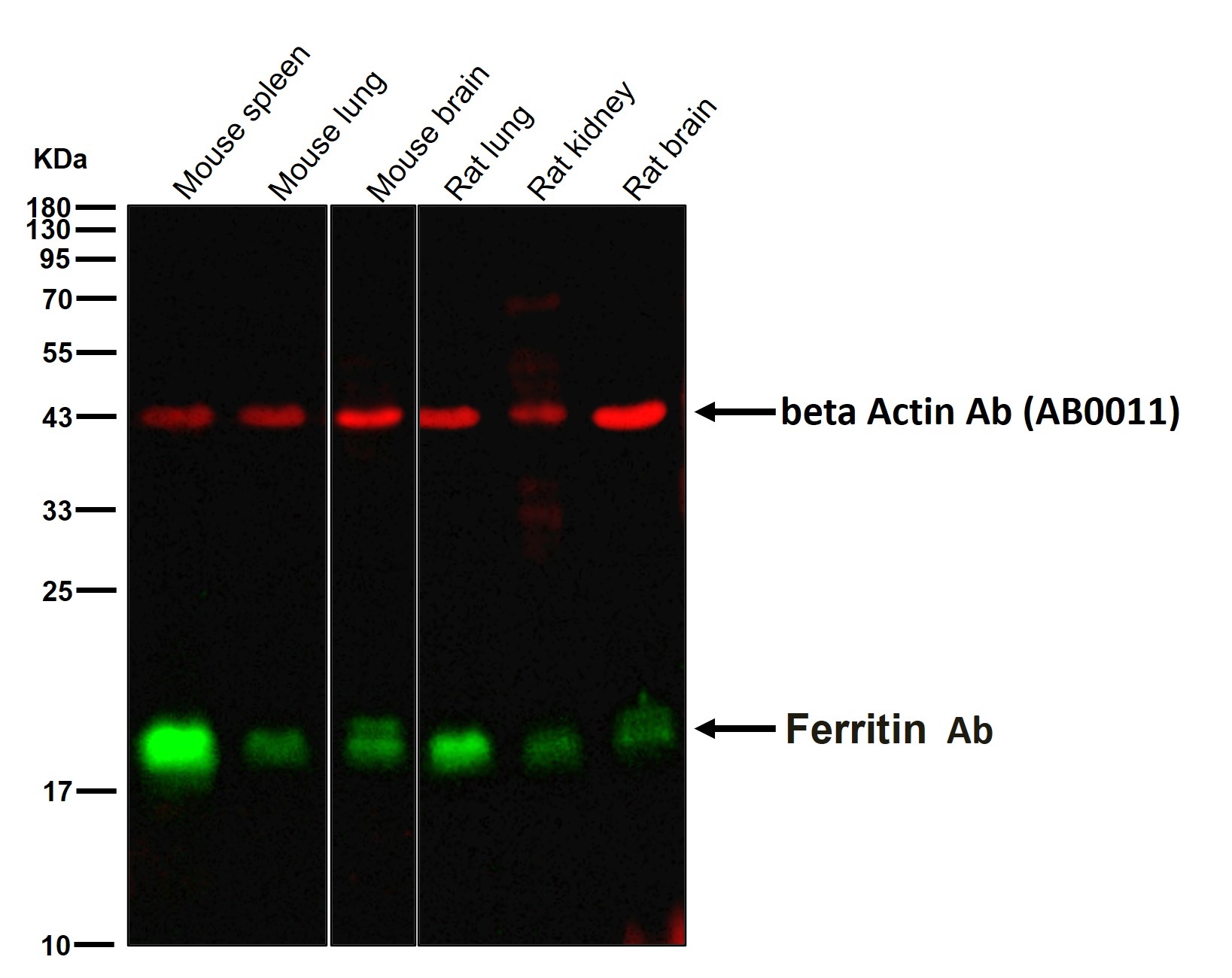 Ferritin Ab