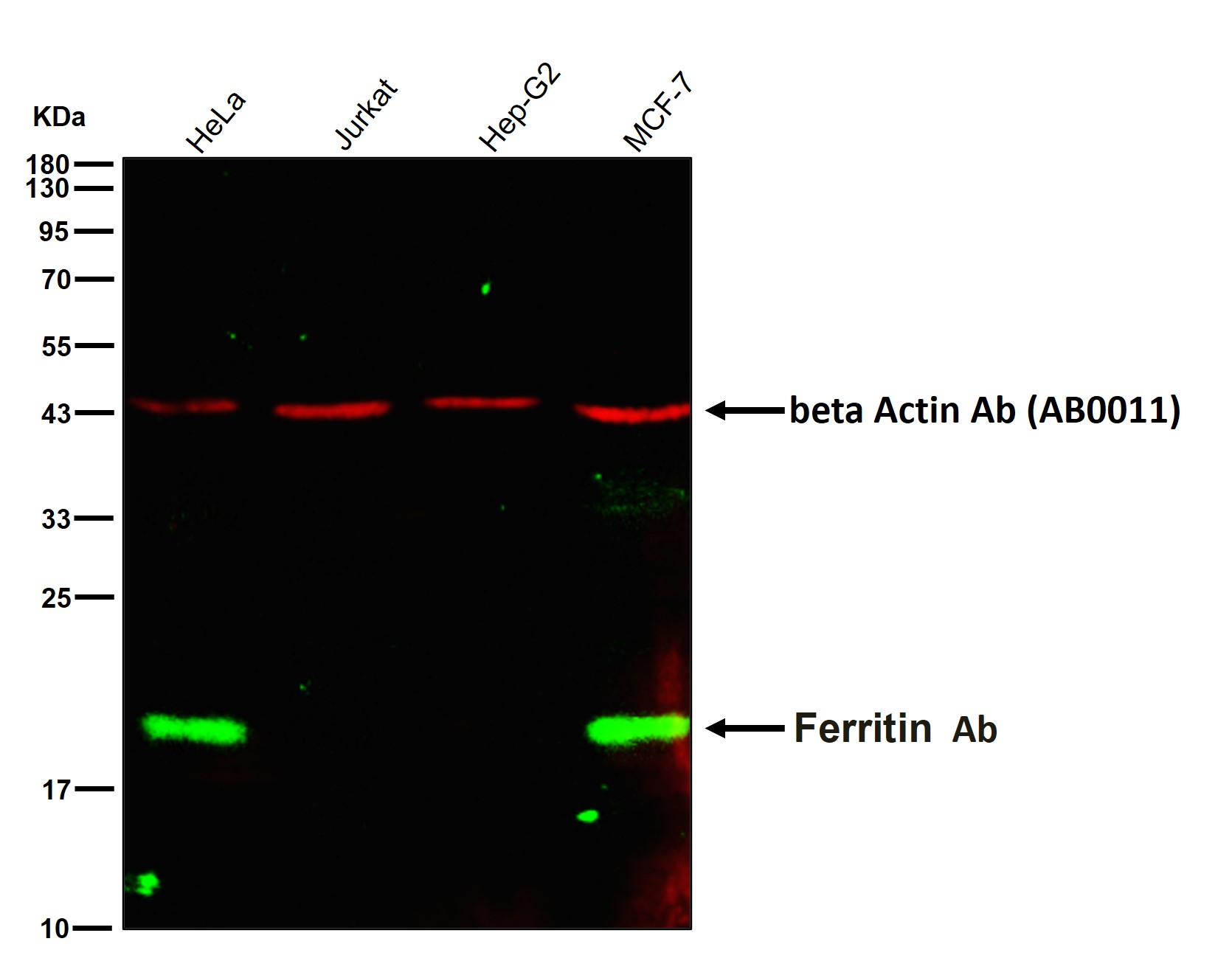 Ferritin Ab