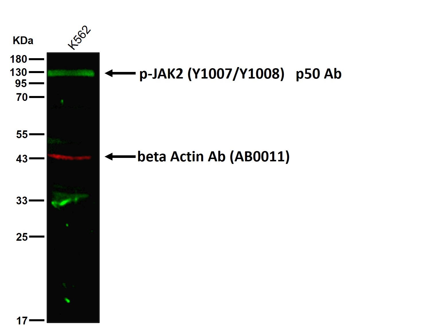 p-JAK2 (Y1007/Y1008) Ab