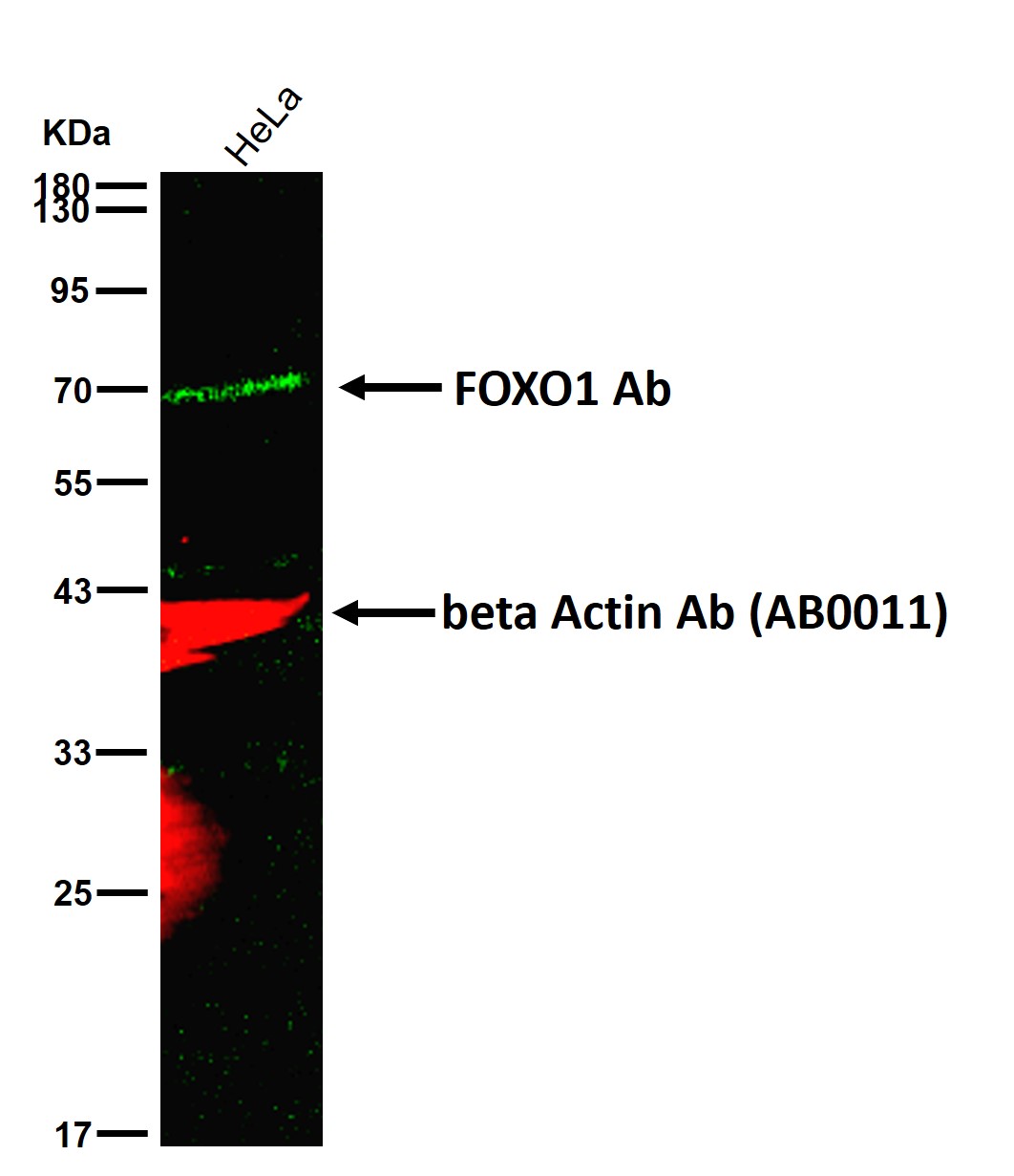 FOXO1 Ab