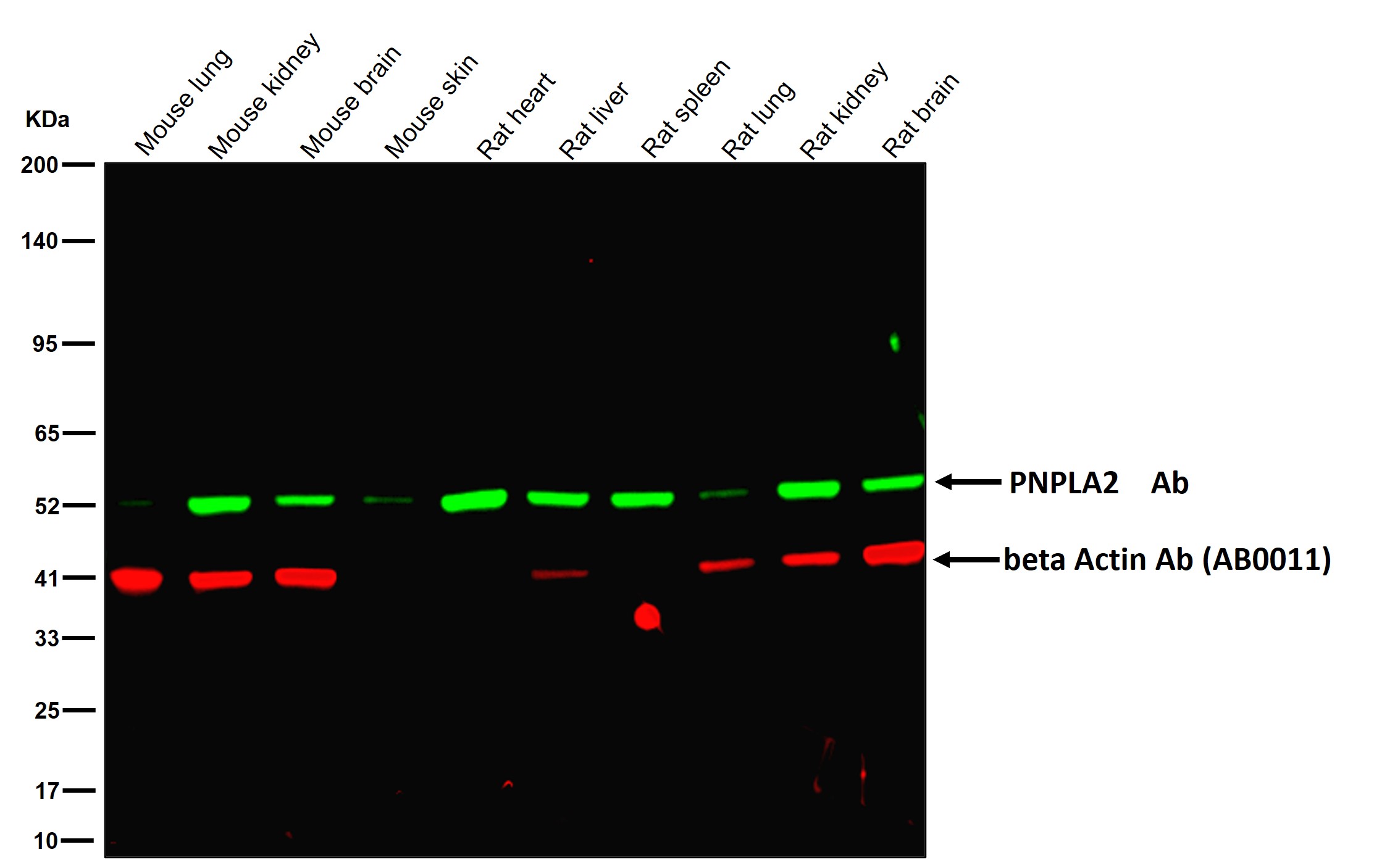 PNPLA2 Ab