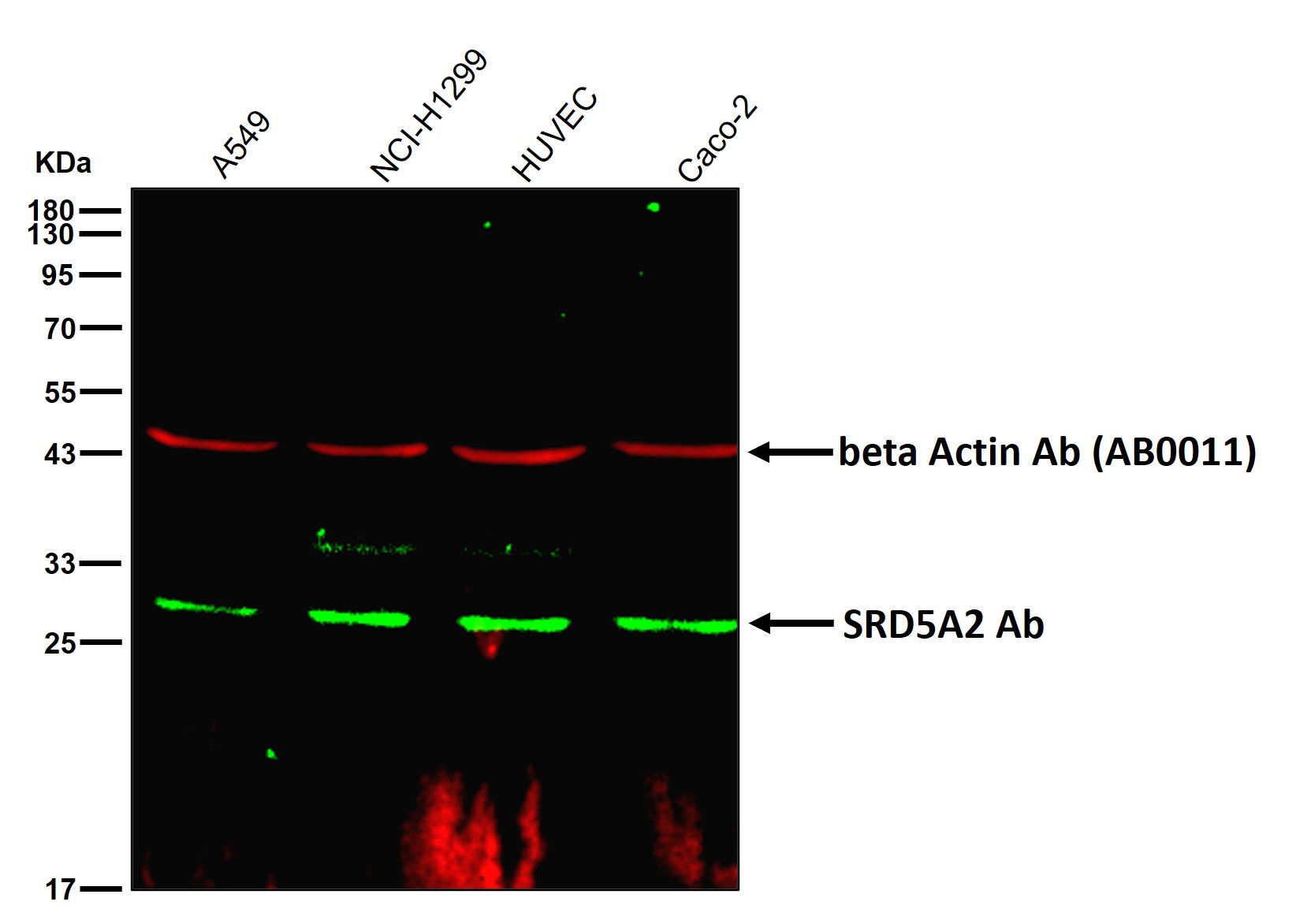 SRD5A2 Ab