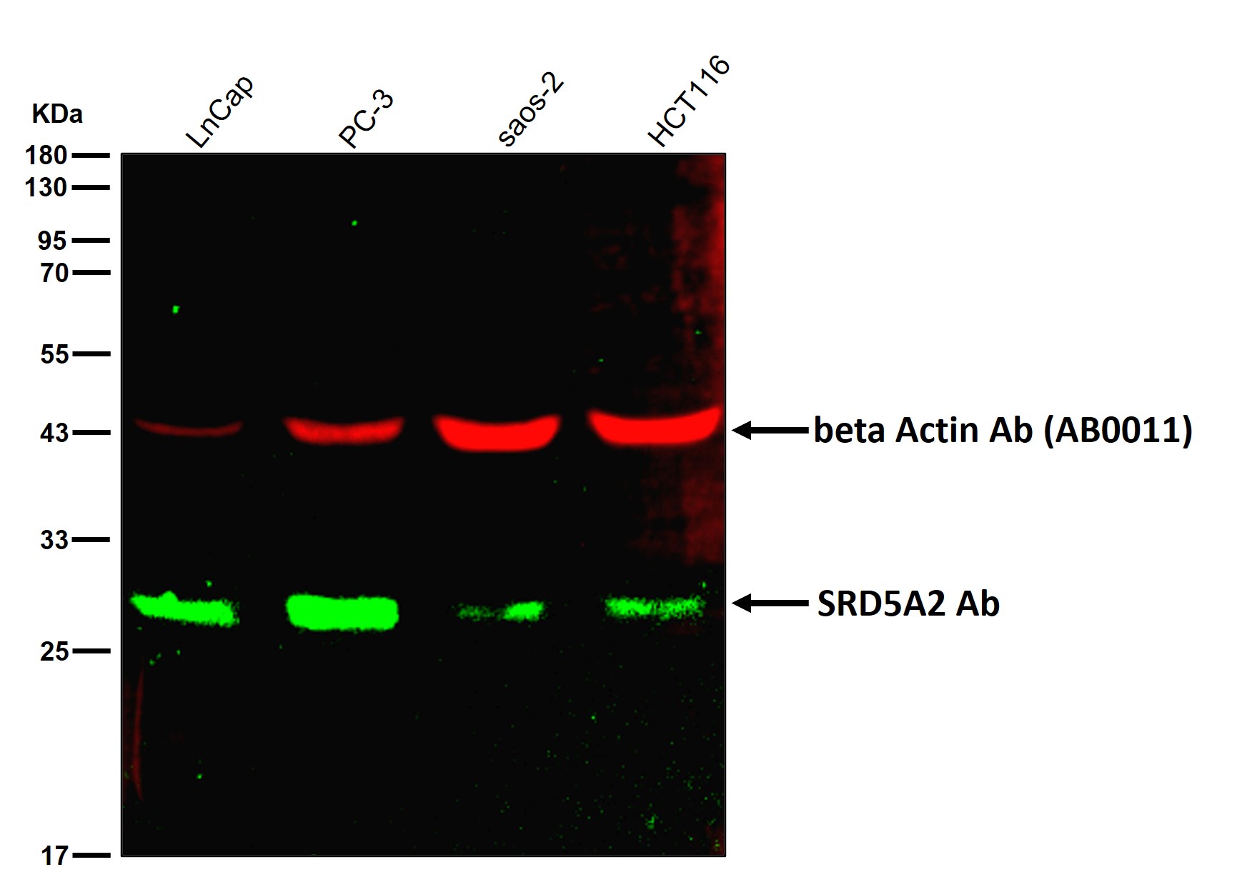 SRD5A2 Ab